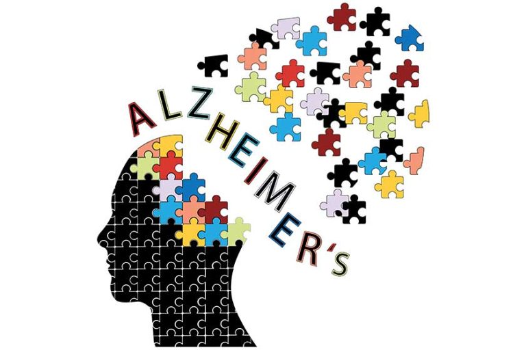 Alzheimer's disease concept