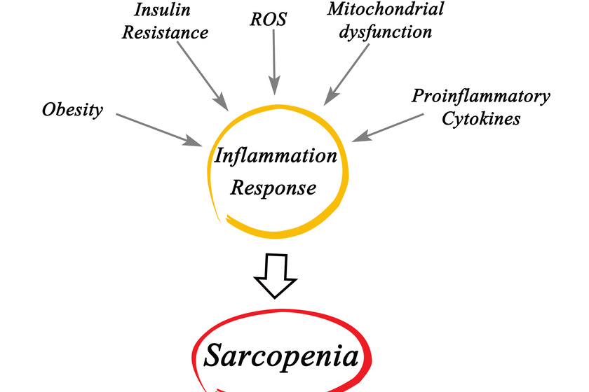 Understanding Sarcopenia: Symptoms, Causes, And Prevention Tips ...