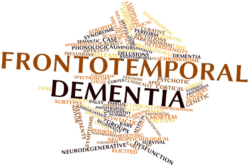 What Is Frontotemporal Dementia Ftd 